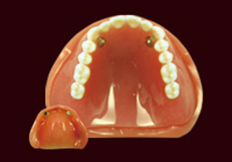 磁性アタッチメント