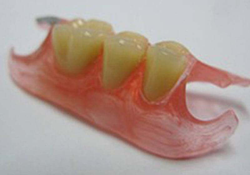 アルティメットデンチャー