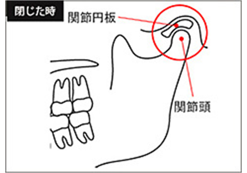 マニピュレーション法