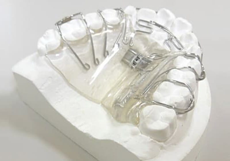 モリカゲ歯科医院が採用している「SH療法」とは？