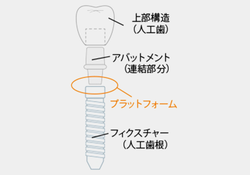 当院は「プラットフォームスイッチング（クローズドタイプ）」を推奨しています