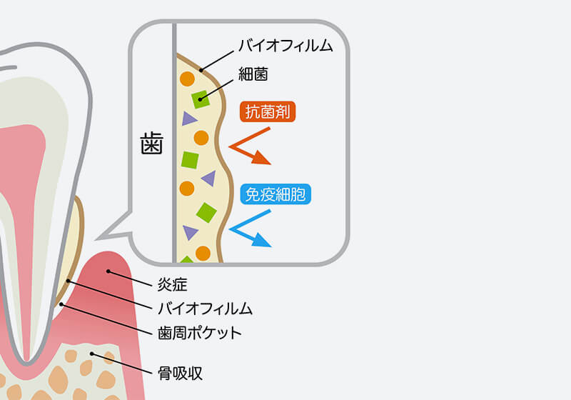 バイオフィルムの除去がとても重要です